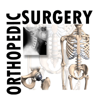 ORTHOPEDIC-SURGERY.gif